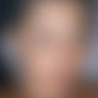 mizzoktoberxxx Desnuda